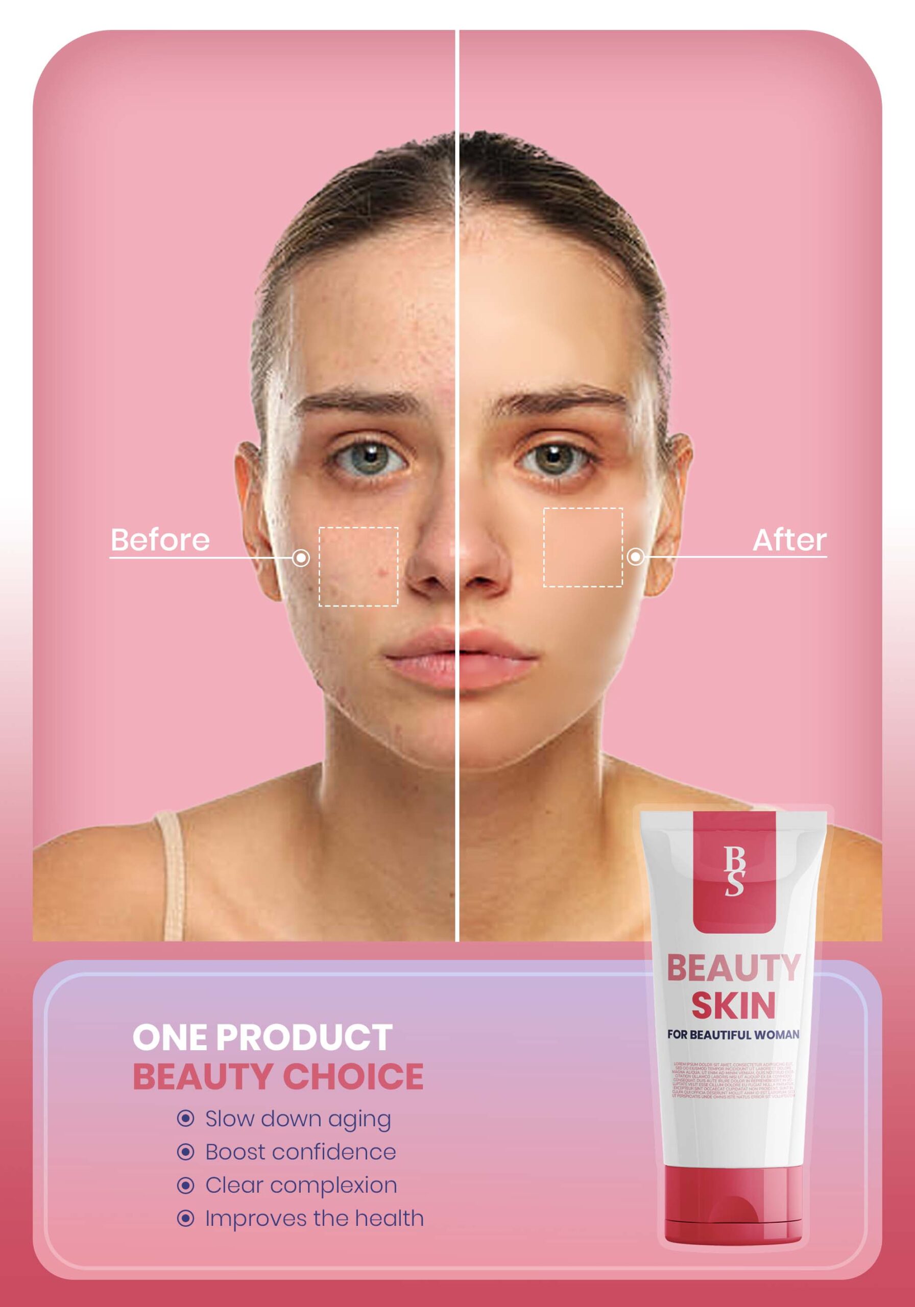 beforeafter